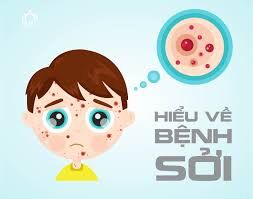 Bệnh sởi: Nguyên nhân, triệu chứng, cách phòng ngừa và điều trị hiệu quả.
