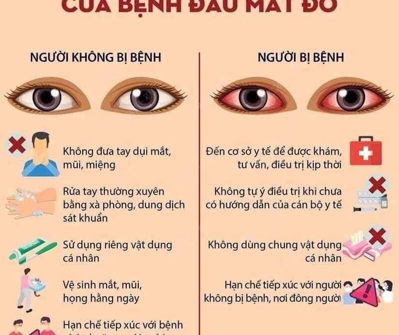 ĐAU MẮT ĐỎ Ở TRẺ EM: NGUYÊN NHÂN, DẤU HIỆU VÀ CÁCH CHẨN ĐOÁN BỆNH