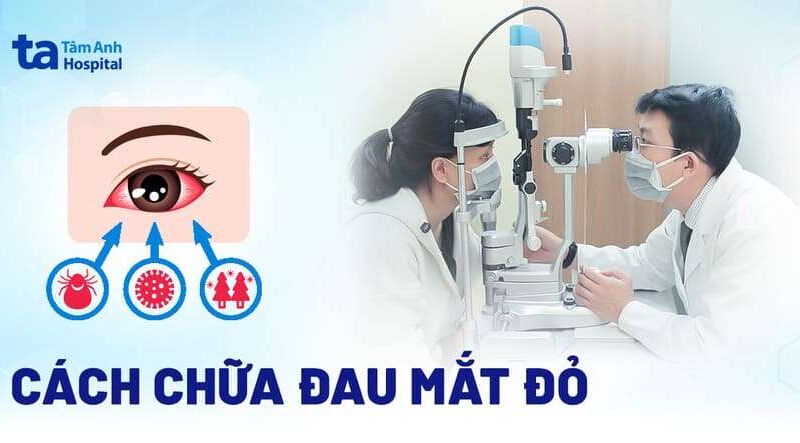 BỆNH ĐAU MÁT ĐỎ, NHỮNG ĐIỀU CẦN BIẾT ĐỂ PHÒNG TRÁNH VÀ  CÁCH CHỮA TRỊ HIỆU QUẢ