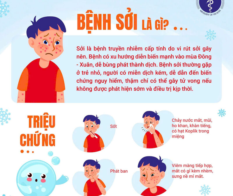 SỞI - NHỮNG THÔNG TIN CẦN BIẾT