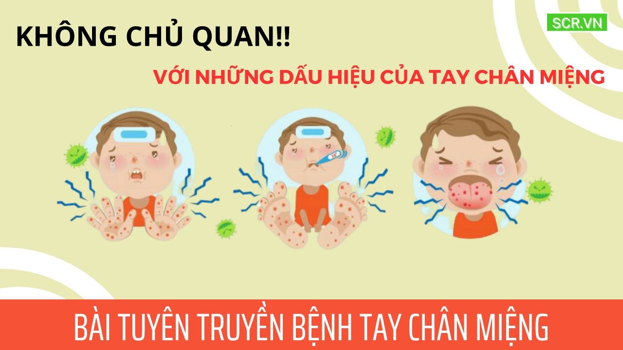Tuyên truyền phòng dịch tay - chân - miệng